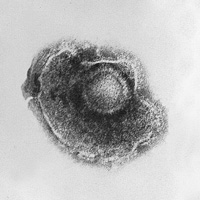 水痘ウイルスの写真